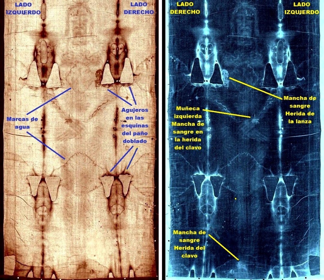 Parte frontal del cuerpo. Negativo (der) y Observación directa (izq)