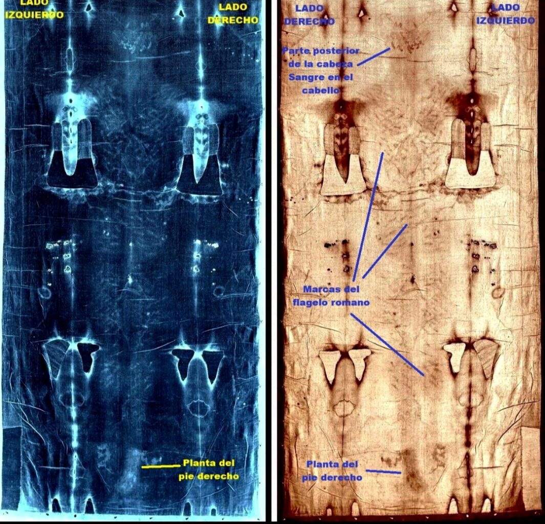 Parte posterior del cuerpo. Negativo (izq). Observacion directa (der)